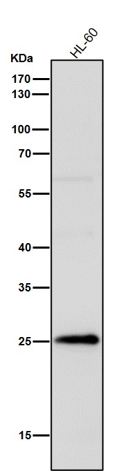 1 - Anti-Interferon gamma IFNG Rabbit Monoclonal Antibody ABO14231
