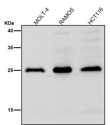 1 - Anti-Interferon gamma IFNG Rabbit Monoclonal Antibody ABO14231