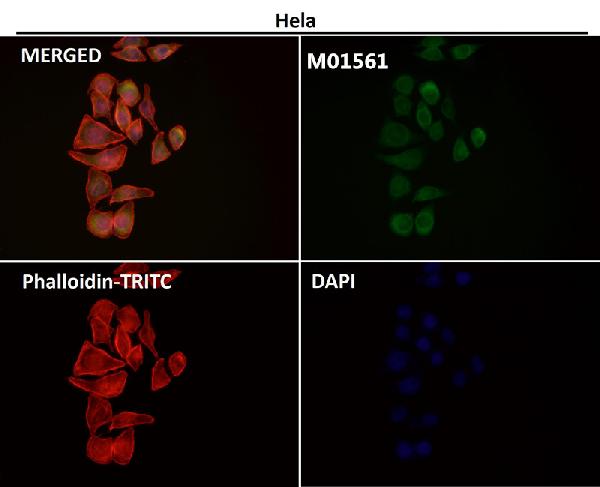 1 - Anti-Integrin alpha V ITGAV Rabbit Monoclonal Antibody ABO14232