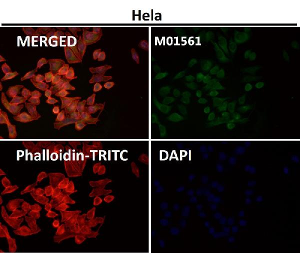 1 - Anti-Integrin alpha V ITGAV Rabbit Monoclonal Antibody ABO14232