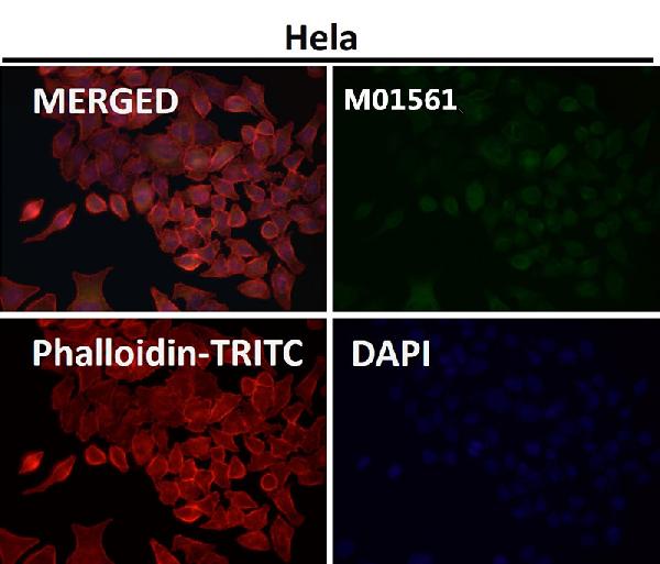 1 - Anti-Integrin alpha V ITGAV Rabbit Monoclonal Antibody ABO14232