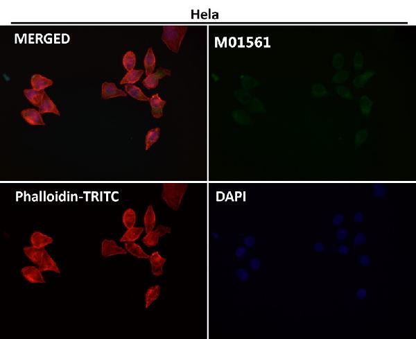 1 - Anti-Integrin alpha V ITGAV Rabbit Monoclonal Antibody ABO14232