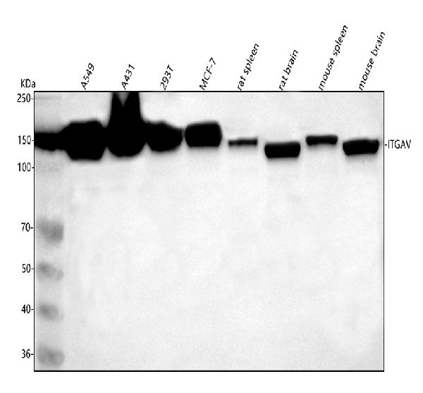 1 - Anti-Integrin alpha V ITGAV Rabbit Monoclonal Antibody ABO14232