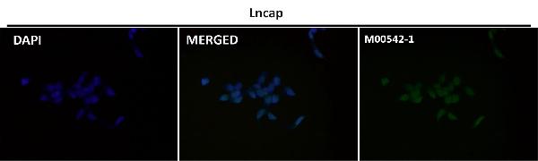 1 - Anti-Androgen Receptor AR Rabbit Monoclonal Antibody ABO14233