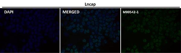 1 - Anti-Androgen Receptor AR Rabbit Monoclonal Antibody ABO14233