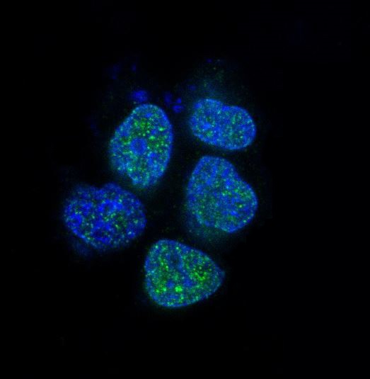 3 - Anti-Androgen Receptor AR Rabbit Monoclonal Antibody ABO14233