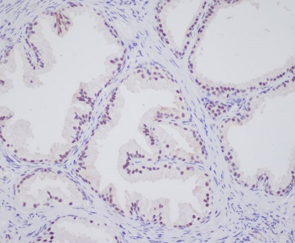 2 - Anti-Androgen Receptor AR Rabbit Monoclonal Antibody ABO14233