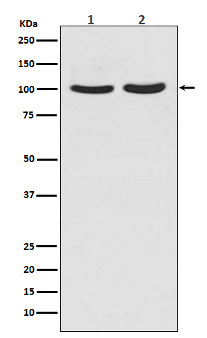 1 - Anti-Androgen Receptor AR Rabbit Monoclonal Antibody ABO14233
