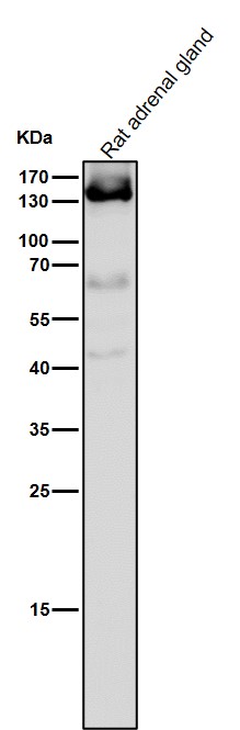 1 - Anti-Androgen Receptor AR Rabbit Monoclonal Antibody ABO14233