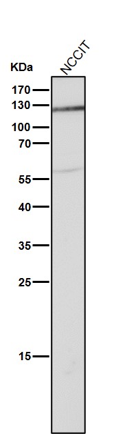 1 - Anti-Androgen Receptor AR Rabbit Monoclonal Antibody ABO14233