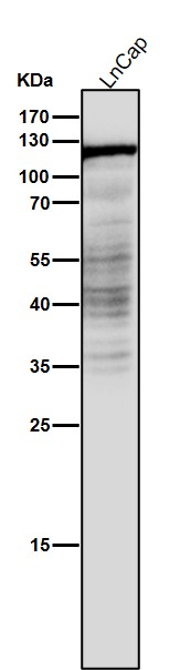 1 - Anti-Androgen Receptor AR Rabbit Monoclonal Antibody ABO14233