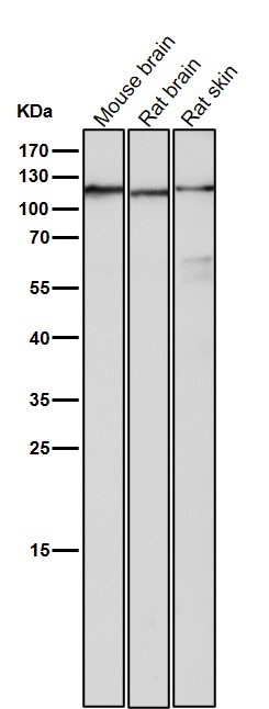 1 - Anti-Androgen Receptor AR Rabbit Monoclonal Antibody ABO14233