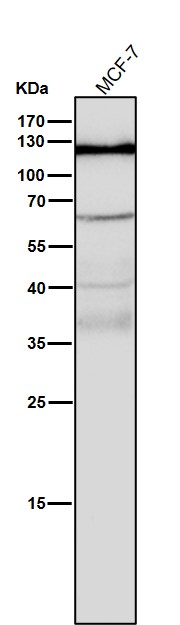 1 - Anti-Androgen Receptor AR Rabbit Monoclonal Antibody ABO14233