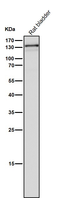 1 - Anti-Androgen Receptor AR Rabbit Monoclonal Antibody ABO14233
