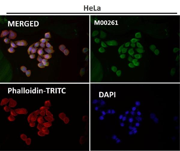 1 - Anti-NAK/TBK1 (N-term) Rabbit Monoclonal Antibody ABO14234