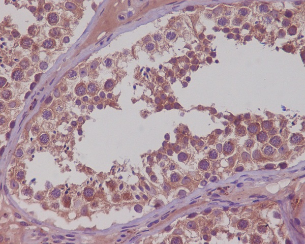 2 - Anti-NAK/TBK1 (N-term) Rabbit Monoclonal Antibody ABO14234