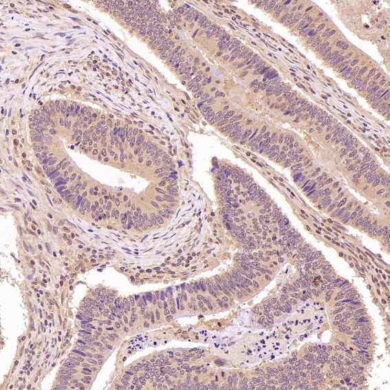 2 - Anti-NAK/TBK1 (N-term) Rabbit Monoclonal Antibody ABO14234
