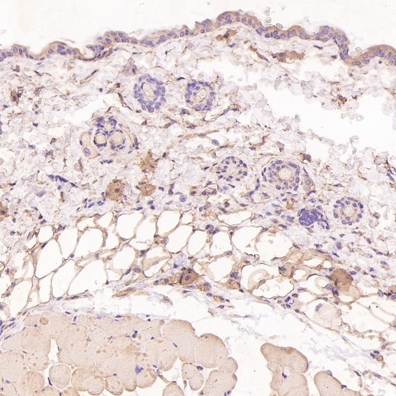 2 - Anti-NAK/TBK1 (N-term) Rabbit Monoclonal Antibody ABO14234