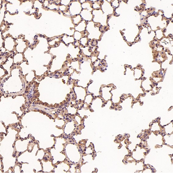 2 - Anti-NAK/TBK1 (N-term) Rabbit Monoclonal Antibody ABO14234