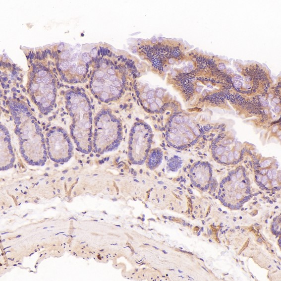 2 - Anti-NAK/TBK1 (N-term) Rabbit Monoclonal Antibody ABO14234