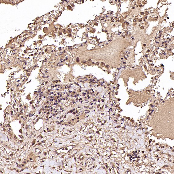 2 - Anti-NAK/TBK1 (N-term) Rabbit Monoclonal Antibody ABO14234