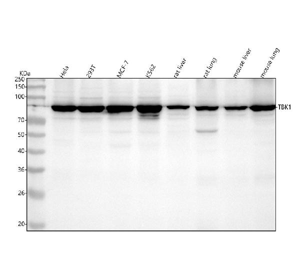 1 - Anti-NAK/TBK1 (N-term) Rabbit Monoclonal Antibody ABO14234