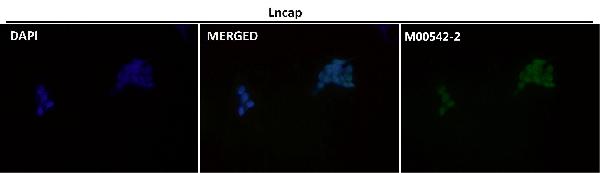 1 - Anti-Androgen Receptor AR Rabbit Monoclonal Antibody ABO14235