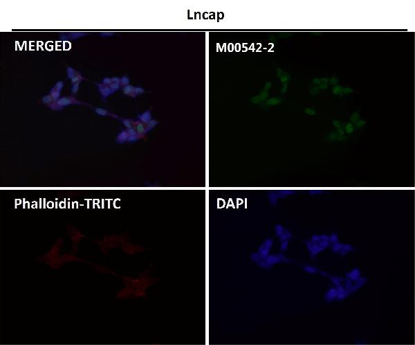 1 - Anti-Androgen Receptor AR Rabbit Monoclonal Antibody ABO14235