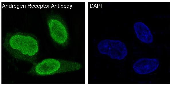 3 - Anti-Androgen Receptor AR Rabbit Monoclonal Antibody ABO14235