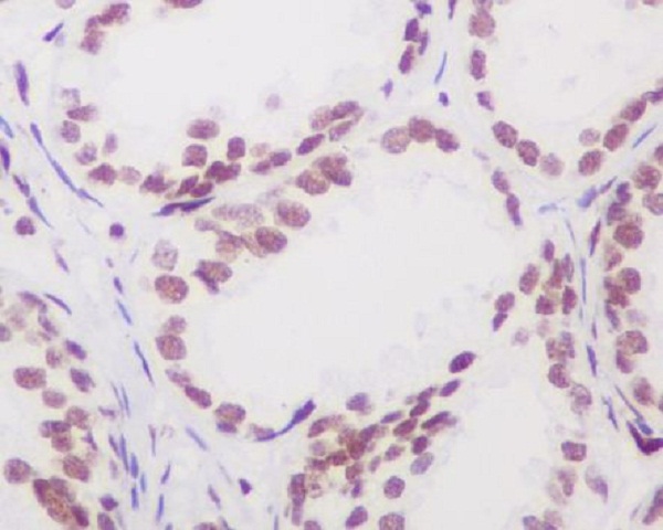 2 - Anti-Androgen Receptor AR Rabbit Monoclonal Antibody ABO14235
