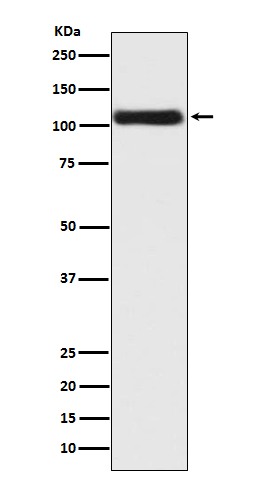 1 - Anti-Androgen Receptor AR Rabbit Monoclonal Antibody ABO14235