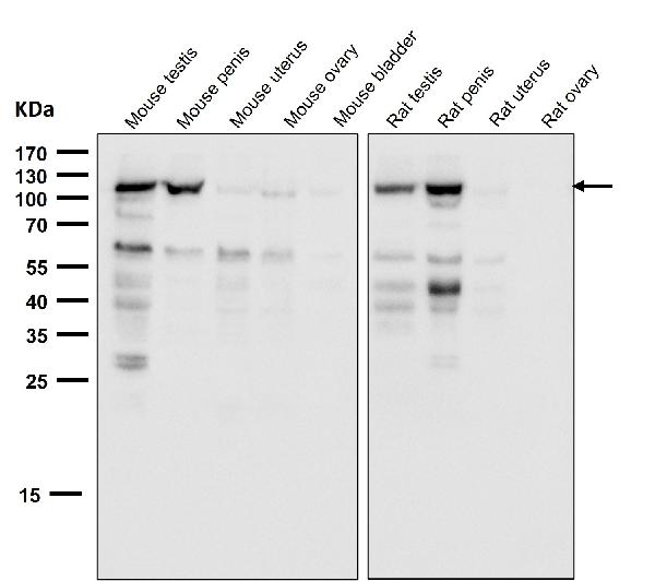 1 - Anti-Androgen Receptor AR Rabbit Monoclonal Antibody ABO14235