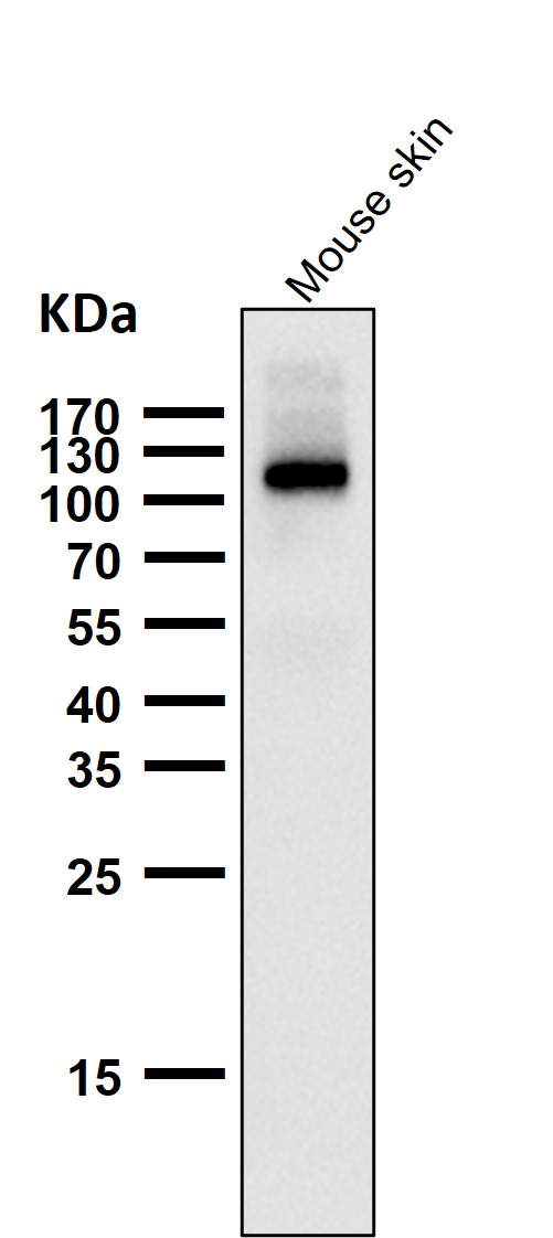 1 - Anti-Androgen Receptor AR Rabbit Monoclonal Antibody ABO14235