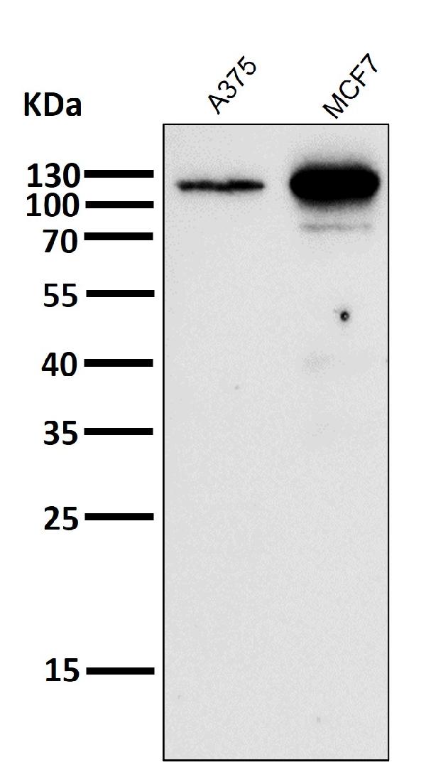 1 - Anti-Androgen Receptor AR Rabbit Monoclonal Antibody ABO14235
