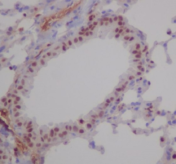 2 - Anti-RUNX1/RUNX2/RUNX3 Rabbit Monoclonal Antibody ABO14236
