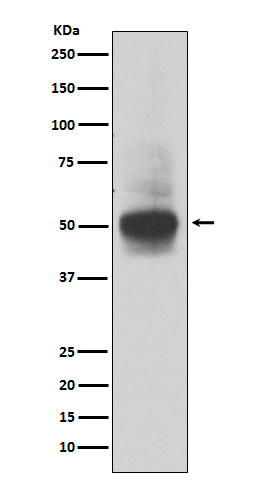 1 - Anti-RUNX1/RUNX2/RUNX3 Rabbit Monoclonal Antibody ABO14236