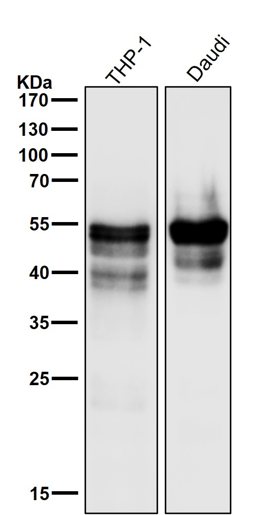 1 - Anti-RUNX1/RUNX2/RUNX3 Rabbit Monoclonal Antibody ABO14236