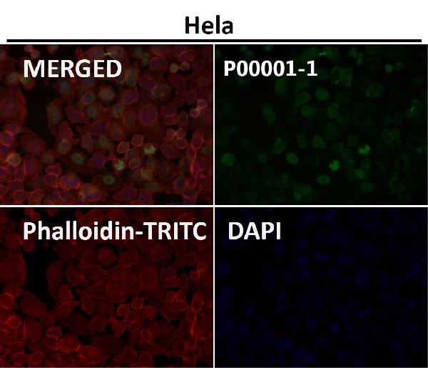 1 - Anti-p53 (acetyl K370) TP53 Rabbit Monoclonal Antibody ABO14237