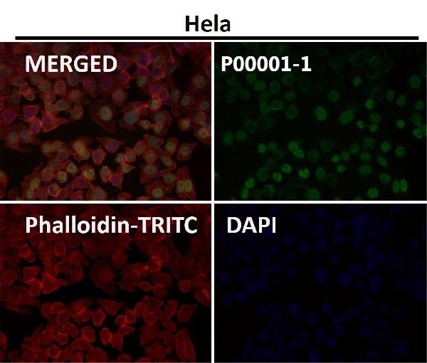 1 - Anti-p53 (acetyl K370) TP53 Rabbit Monoclonal Antibody ABO14237
