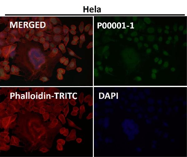 1 - Anti-p53 (acetyl K370) TP53 Rabbit Monoclonal Antibody ABO14237