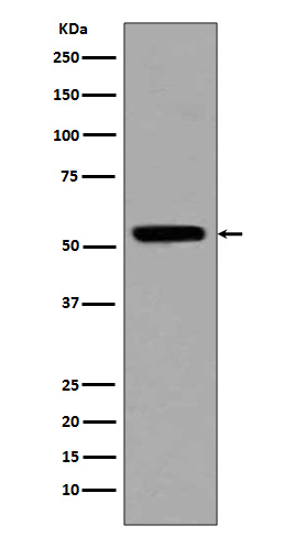 1 - Anti-p53 (acetyl K370) TP53 Rabbit Monoclonal Antibody ABO14237