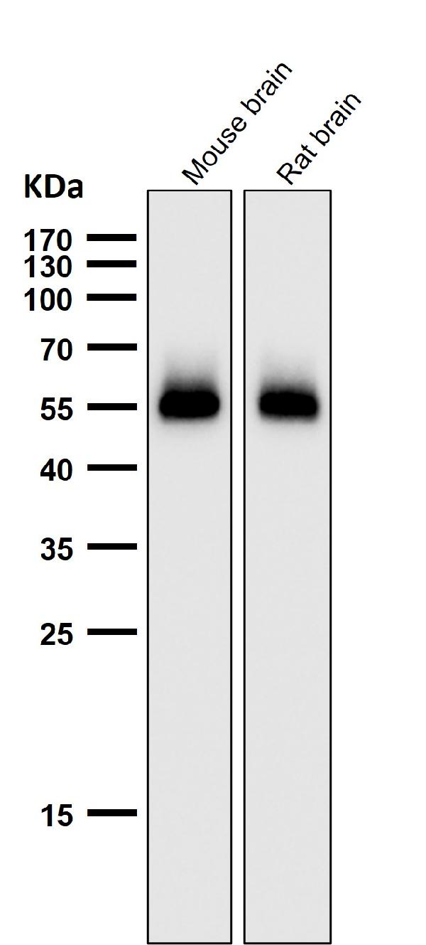 1 - Anti-p53 (acetyl K370) TP53 Rabbit Monoclonal Antibody ABO14237