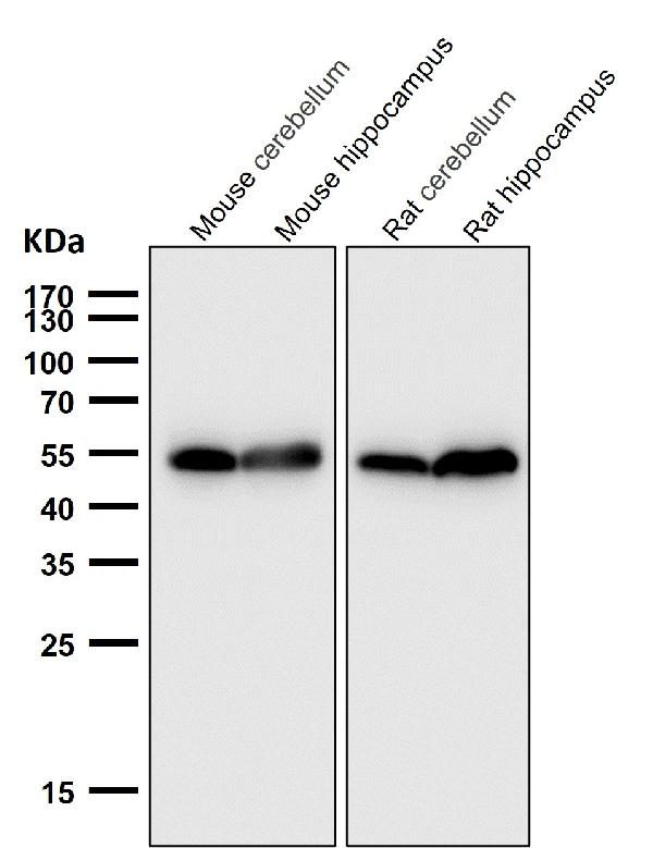 1 - Anti-p53 (acetyl K370) TP53 Rabbit Monoclonal Antibody ABO14237