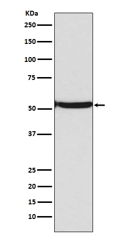 1 - Anti-p53 (acetyl K382) TP53 Rabbit Monoclonal Antibody ABO14238