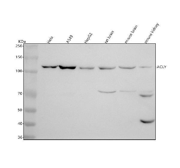 1 - Anti-ATP citrate lyase ACLY Rabbit Monoclonal Antibody ABO14239