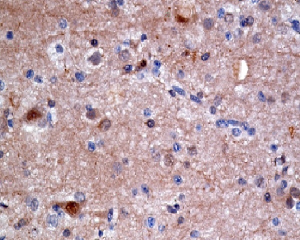 2 - Anti-ATP citrate lyase ACLY Rabbit Monoclonal Antibody ABO14239
