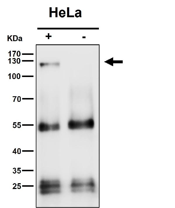 1 - Anti-ATP citrate lyase ACLY Rabbit Monoclonal Antibody ABO14239