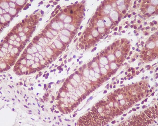 2 - Anti-PP2A alpha + beta Rabbit Monoclonal Antibody ABO14240