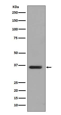 1 - Anti-PP2A alpha + beta Rabbit Monoclonal Antibody ABO14240