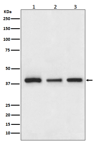 1 - Anti-Cathepsin L/V/K/H Rabbit Monoclonal Antibody ABO14245